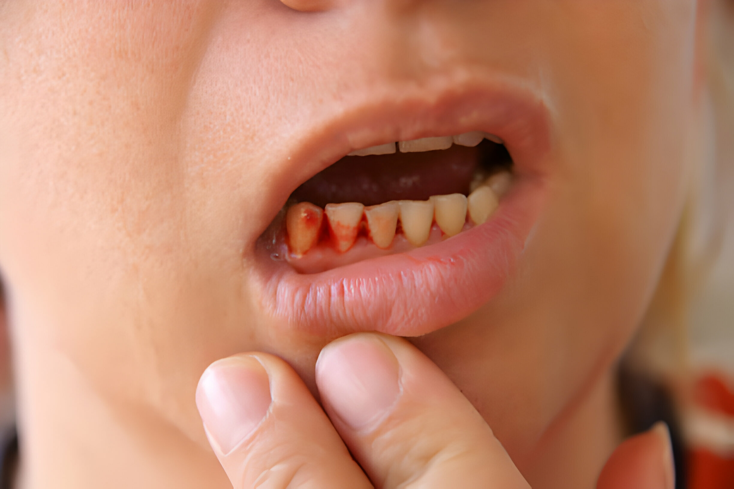 7 Common Dental Emergencies and How to Handle Them_1