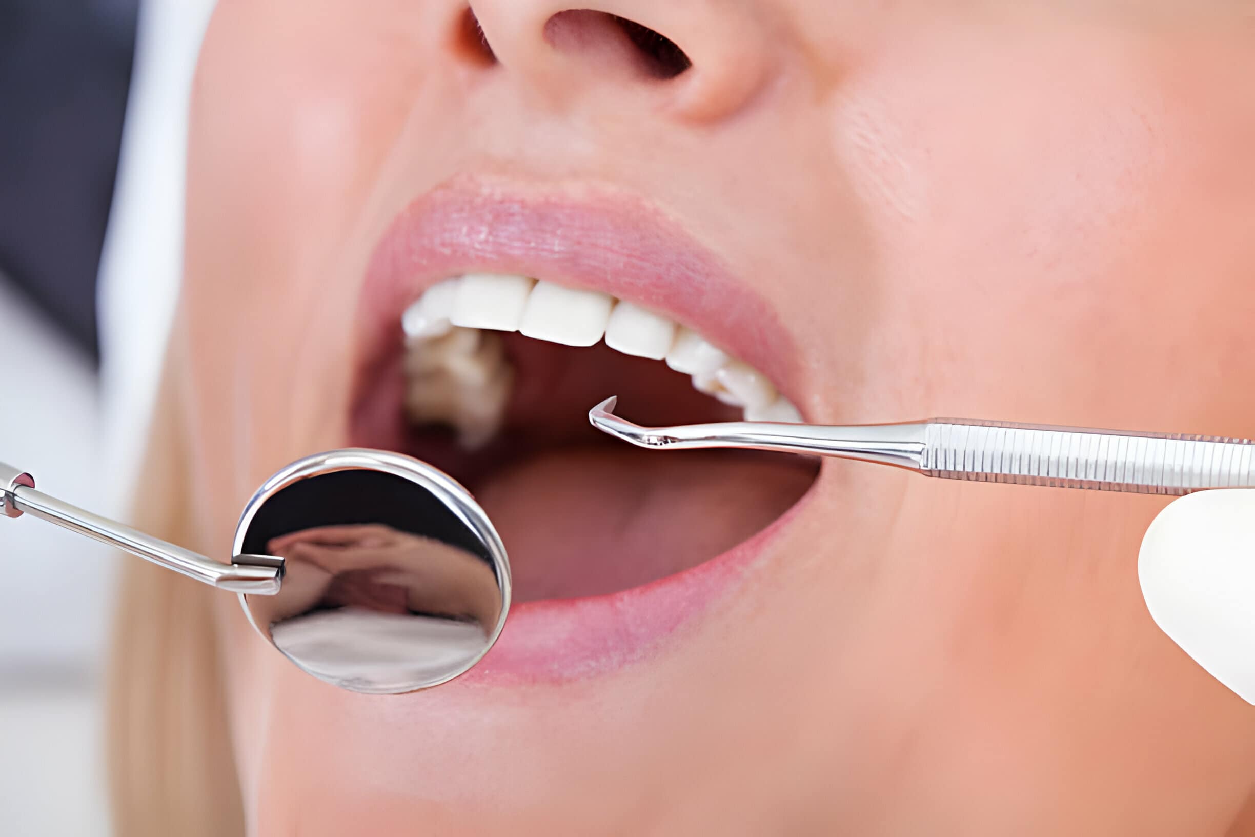 Understanding Your Restorative Dentistry Options In Dallas, GA_1